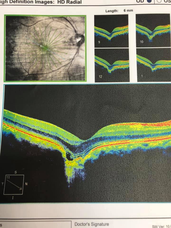 Dr. Sin Pui Yee Helena - Ophthalmologist 冼佩儀眼科專科醫生