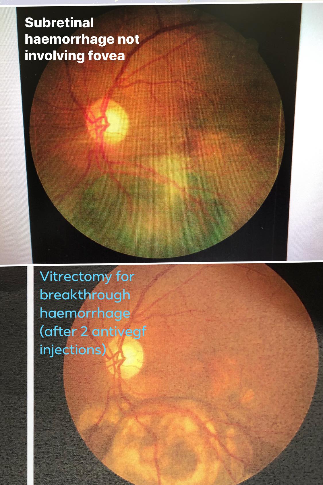 Dr. Sin Pui Yee Helena - Ophthalmologist 冼佩儀眼科專科醫生