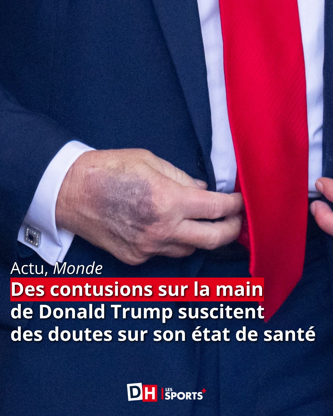 La DH - De plus en plus de clichés montrant les contusions... | Facebook