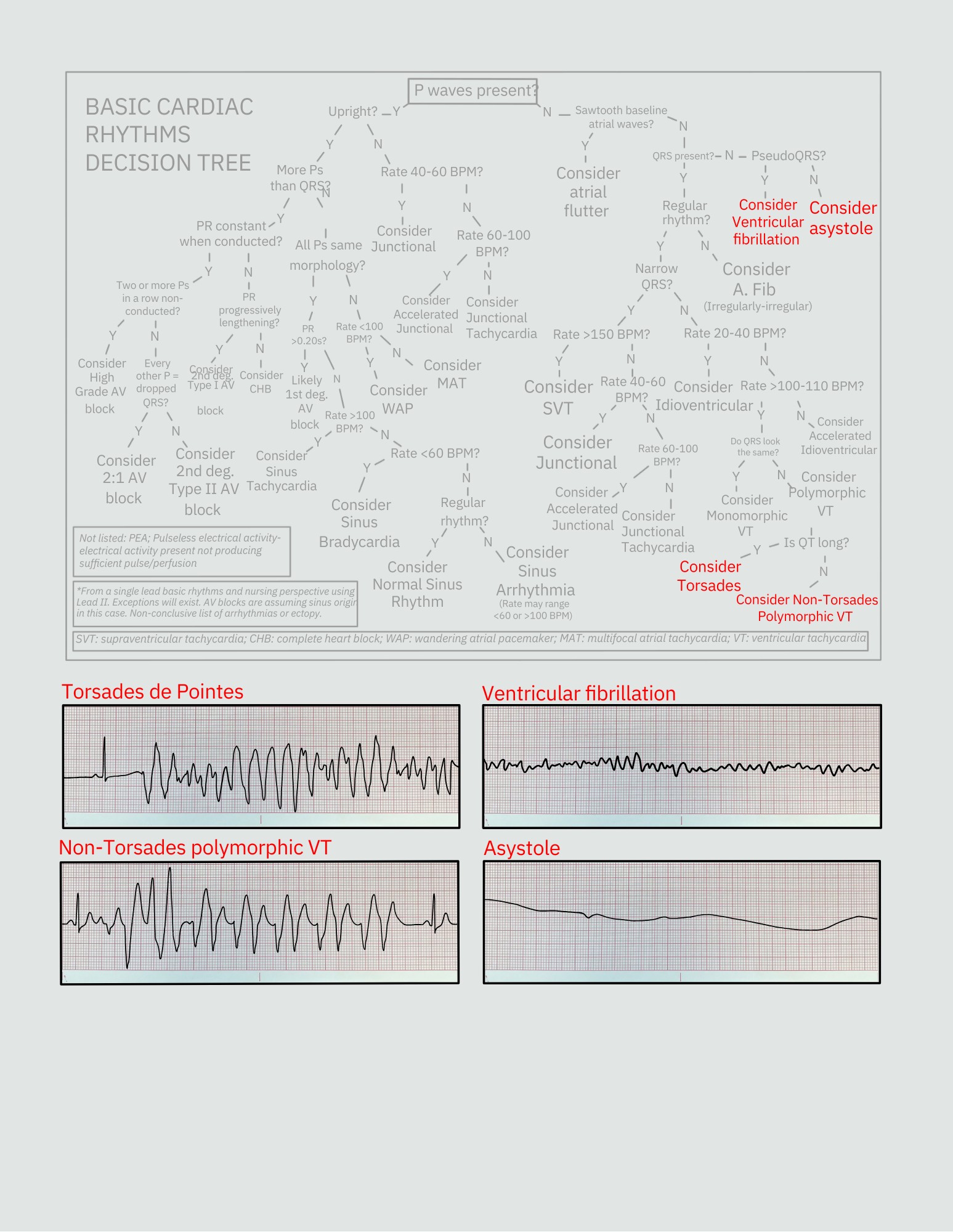 Abdallah Othman - 🔹A clear guide to basic cardiac rhythms!... | Facebook