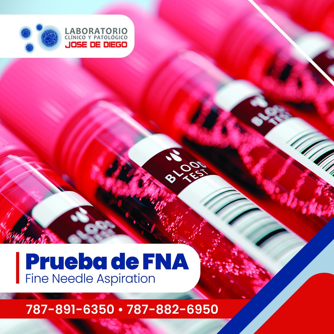 Laboratorio - La prueba de FNA (Fine Needle Aspiration) 💉 determina ...