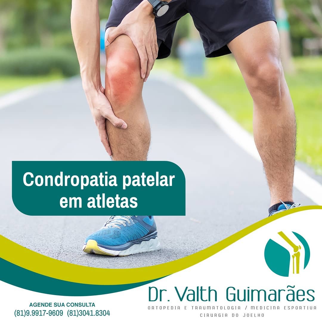 Condromalácia ou... - Dr. Valth Guimarães Ortopedista
