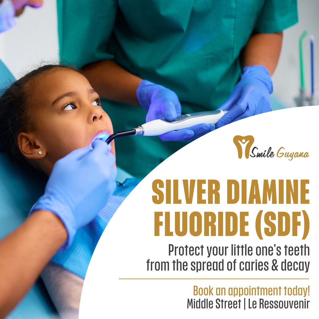 Smile - Silver Diamine Fluoride (SDF) is a liquid substance used to ...