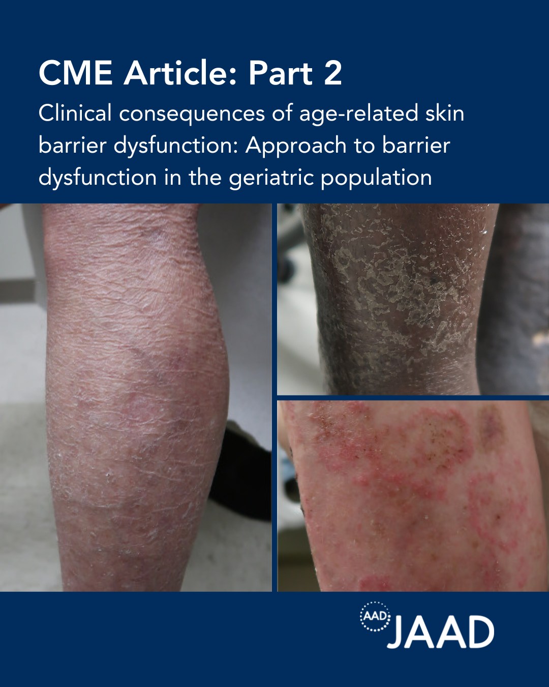 Journal of the American Academy of Dermatology (JAAD)