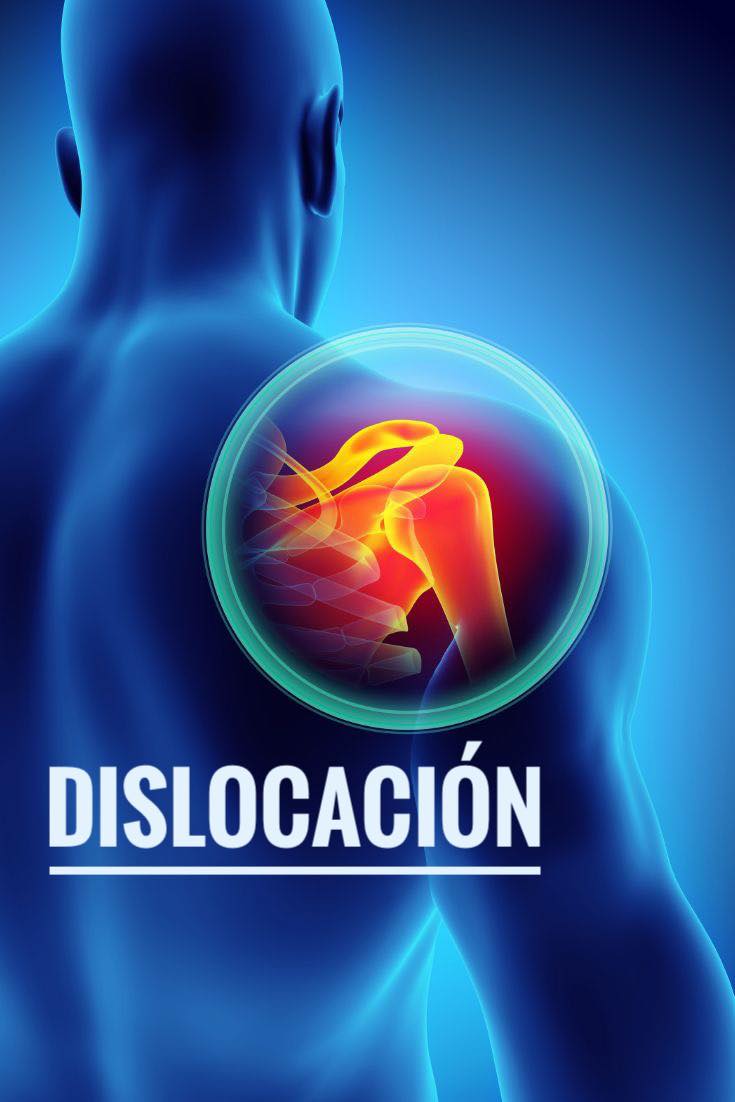 Vivir - ‼️ DISLOCACIÓN: Qué es, cómo ocurre y cómo se trata ‼️ ¿Dolor ...