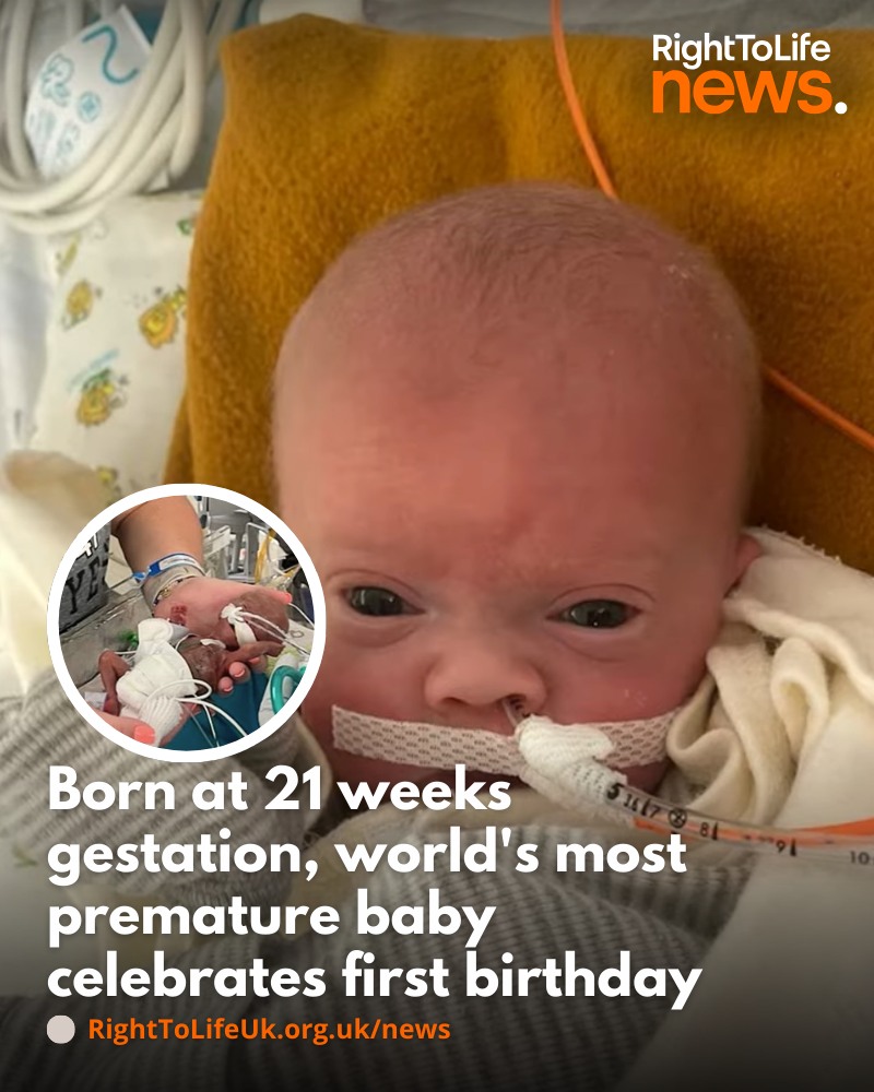 Right - A baby who was given a 0% chance of survival has defied the ...