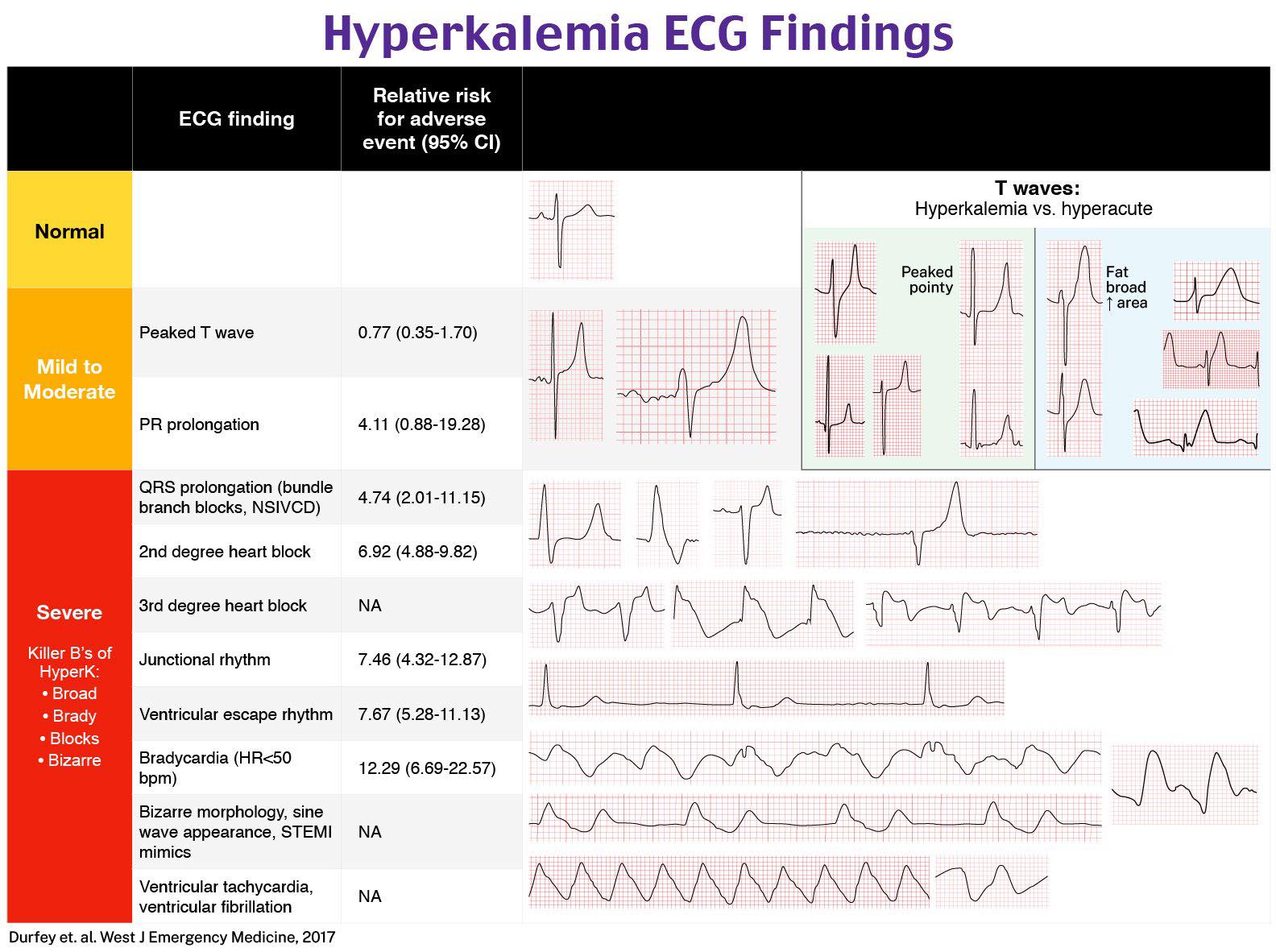 Cardiophilia - The initial electrocardiographic (ECG)... | Facebook