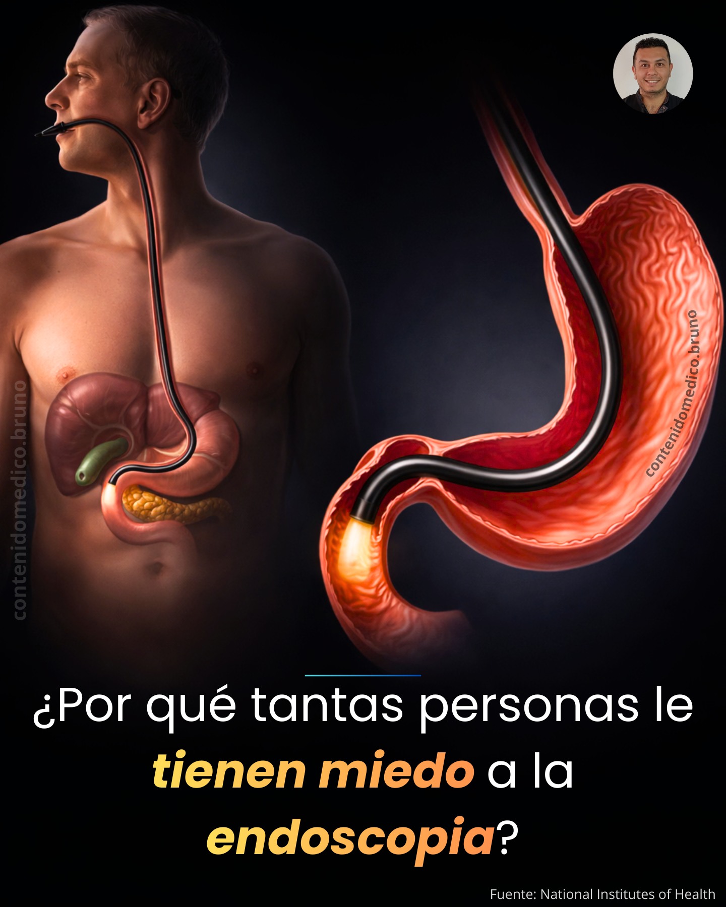 contenidomedico.bruno - 🩺 ¿Por qué no hay que temerle a la endoscopía ...
