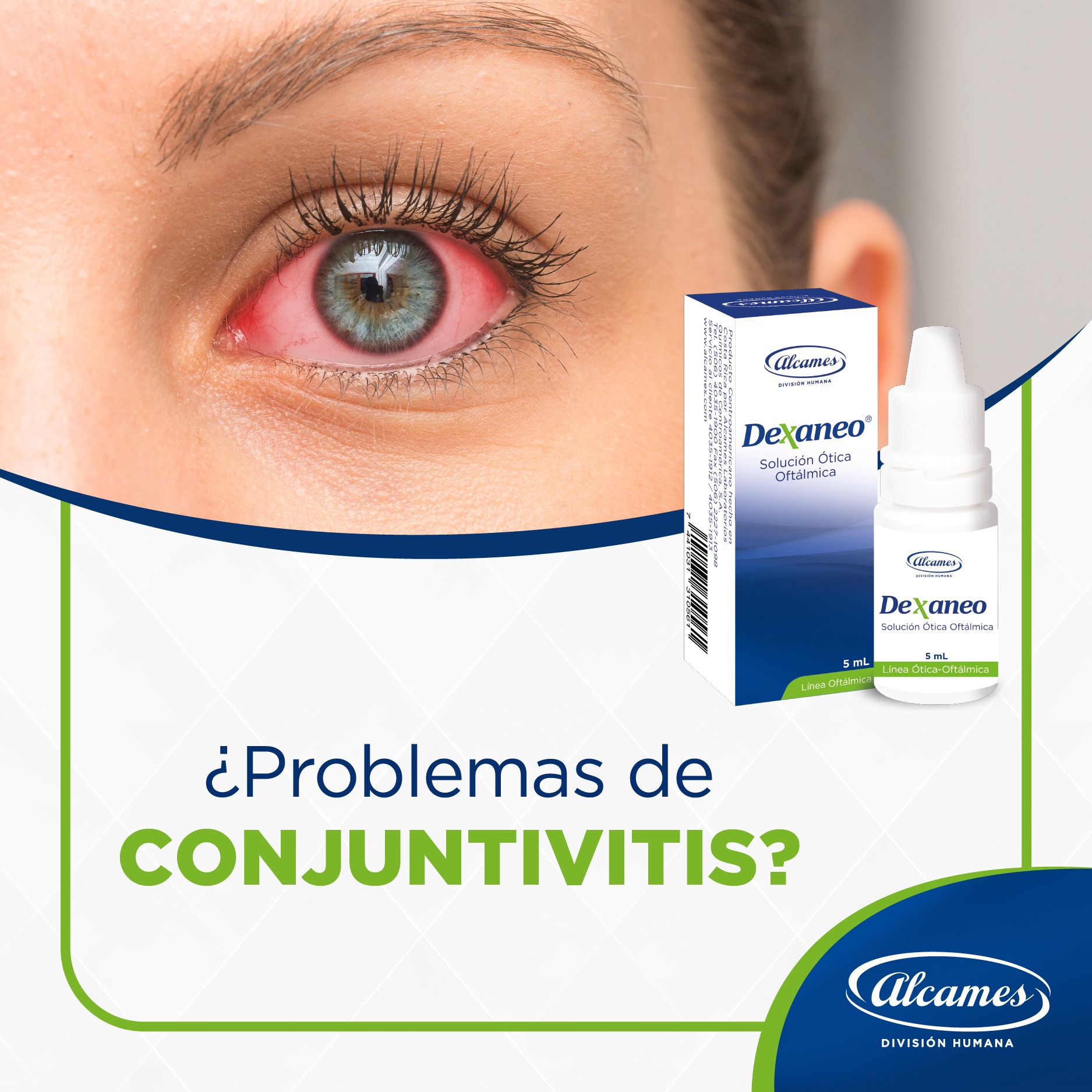 Alcames - 👁️💧 Dexaneo: Alivio para tus ojos Combate la irritación ...