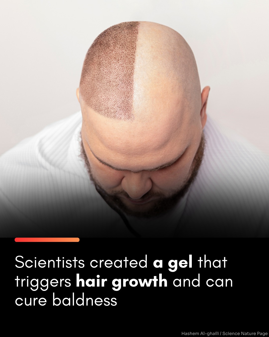 Scientists have developed a new... - Hashem Al-Ghaili | Facebook