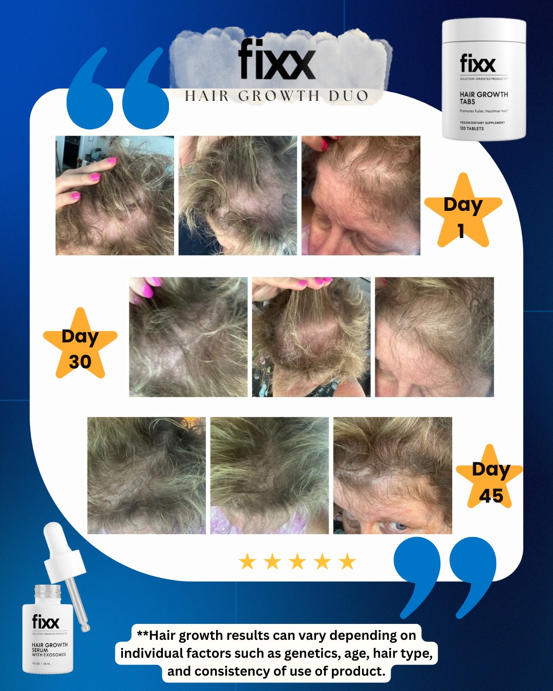 Fixx Hair Growth Duo is a... - Shop.com - Market Singapore | Facebook