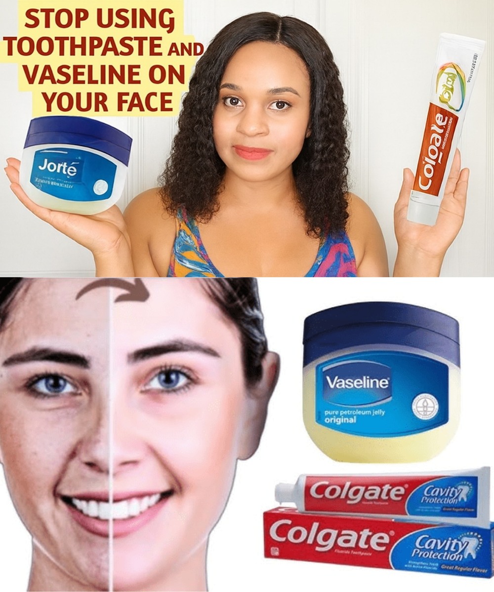 Healthy - I APPLIED COLGATE TOOTHPASTE & VASELINE TO MY FACE AND LOOK ...
