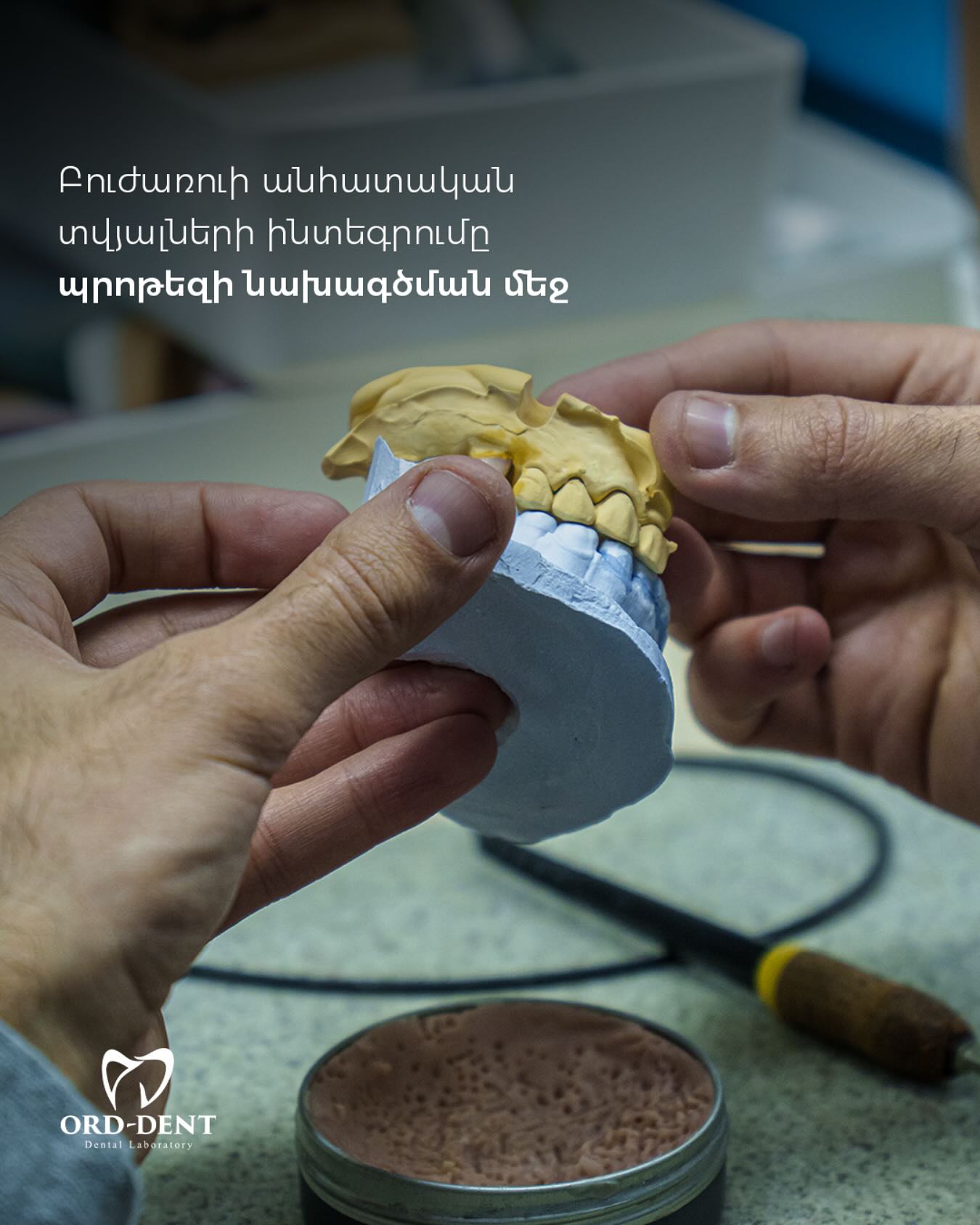 Ord-Dent Dental Laboratory | Yerevan