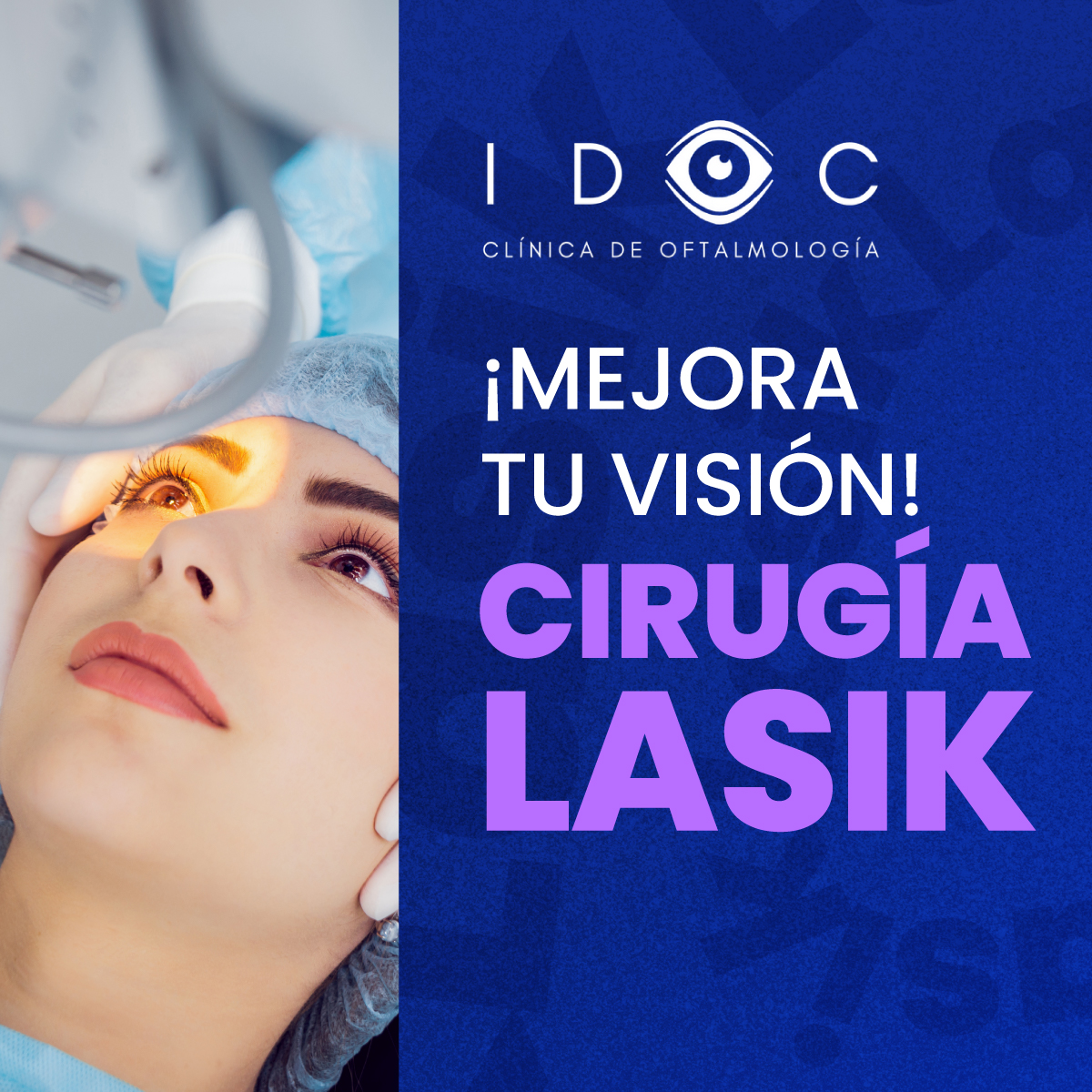 IDOC Clínica de Oftalmología - La cirugía Lasik es una cirugía ...