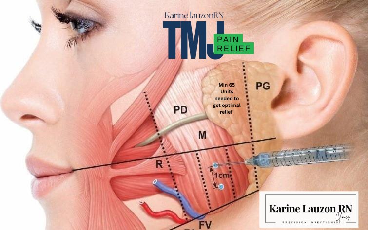Karine - The temporomandibular joints (TMJ) are the 2 joints that ...