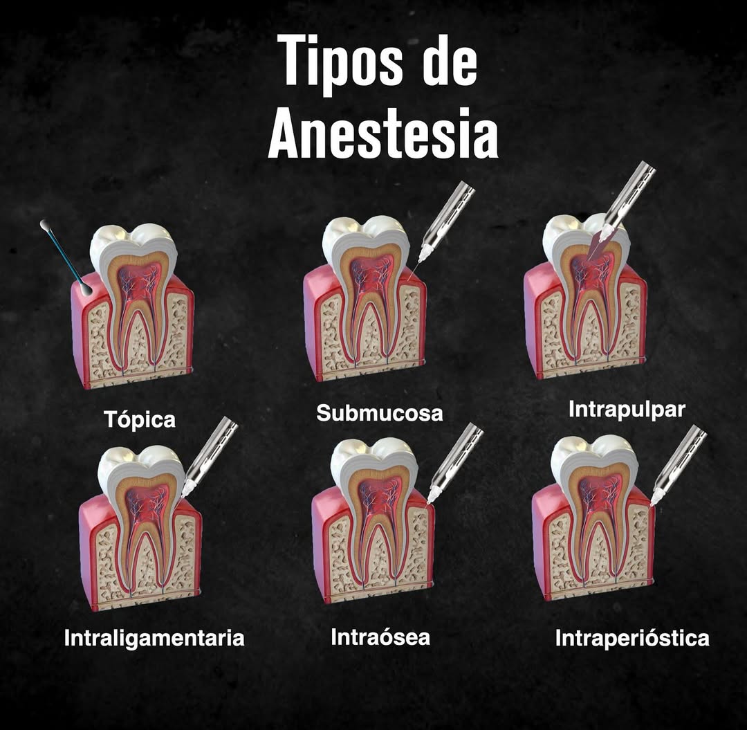 Portal Odontólogos added a new photo. - Portal Odontólogos