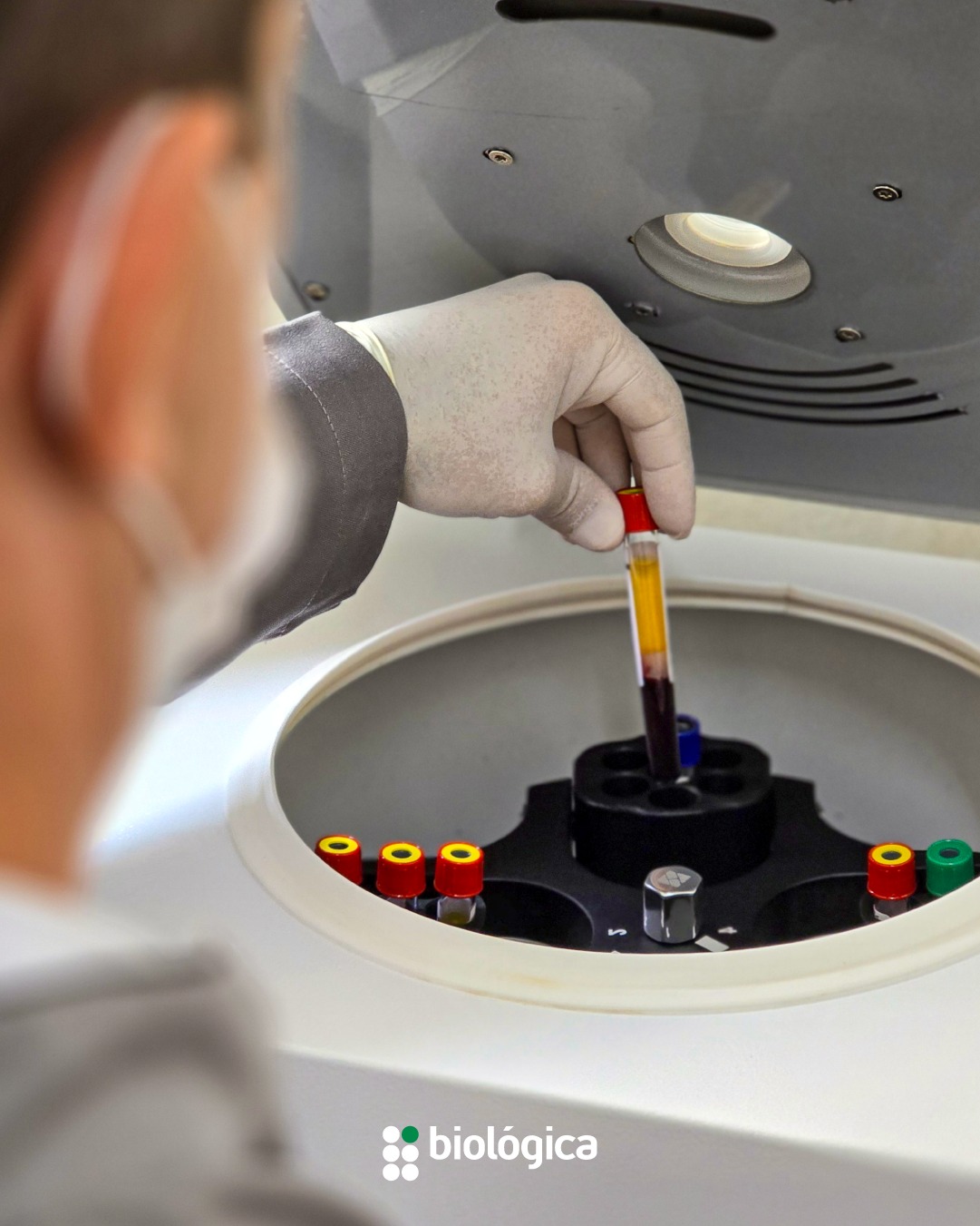 Laboratório - 🔬 A centrifugação do sangue, é um processo essencial para ...
