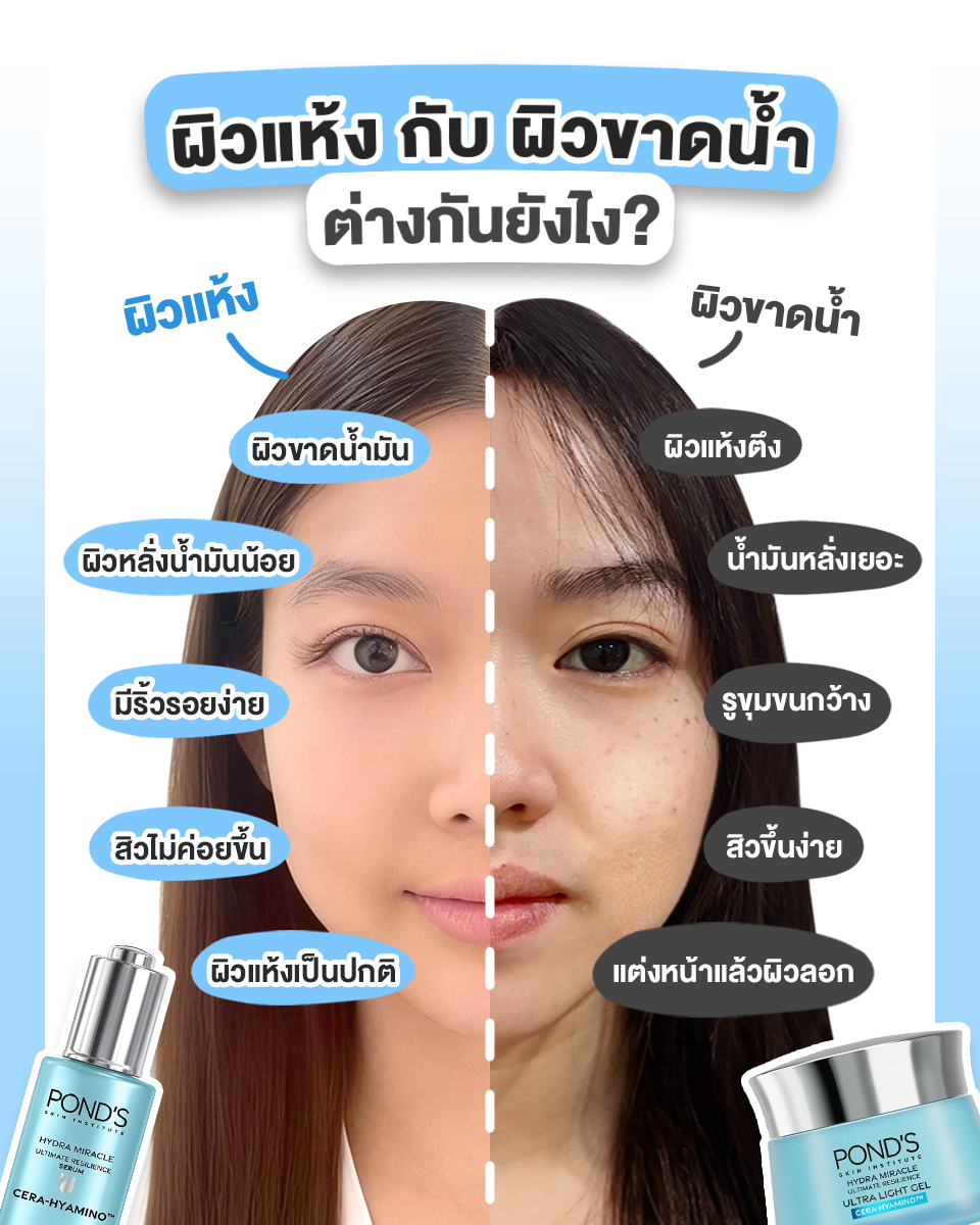 POND'S - ไม่ว่าจะหิวแห้ง หรือผิวมันขาดน้ำ สิ่งที่ผิว 2 แบบนี้เป็น ...