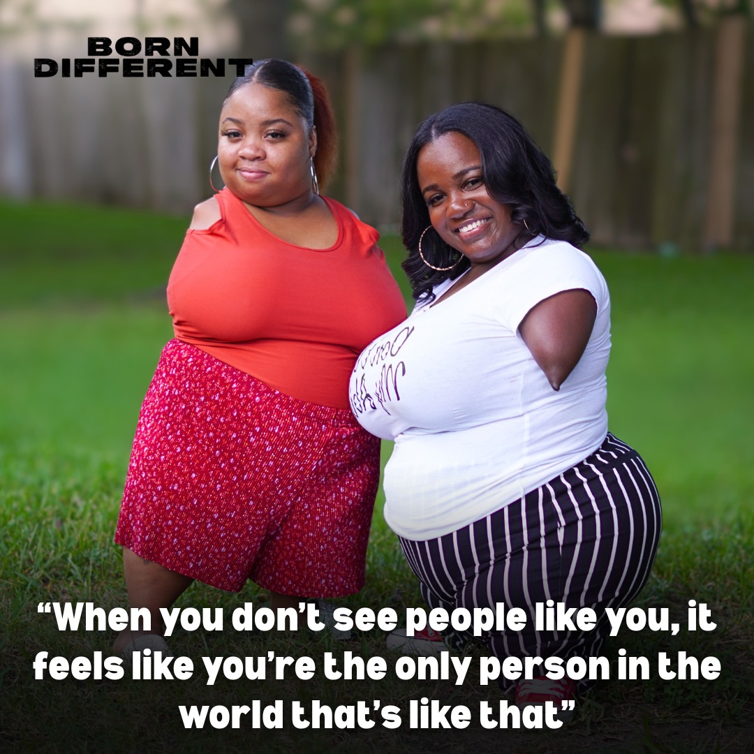 Born - Jlissa stands at 3ft 4” and was born without arms, knees and ...