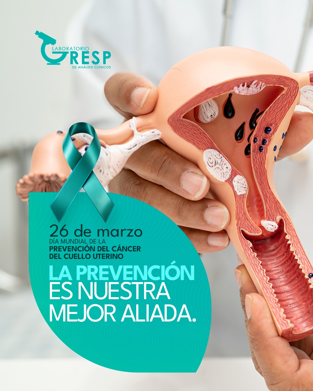 Gresp - El cáncer de cuello uterino se puede prevenir, hoy recordamos ...