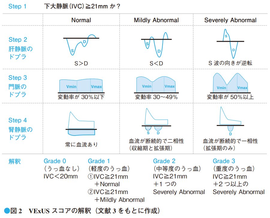 医学界新聞 - 【寄稿】VExUS：輸液耐性が注目される今だからこそ一歩先のPOCUS を（柴﨑俊一） POCUSの延長線上にあるエコー技術で ...