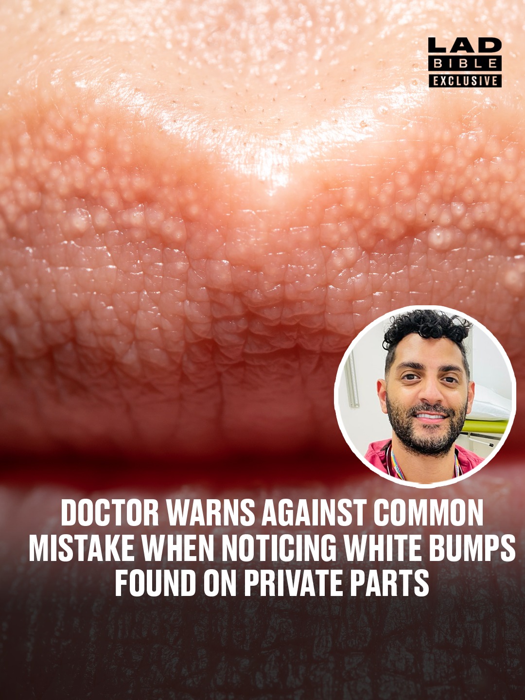 LADbible - They can be found on different parts of your body 🔍 | Facebook