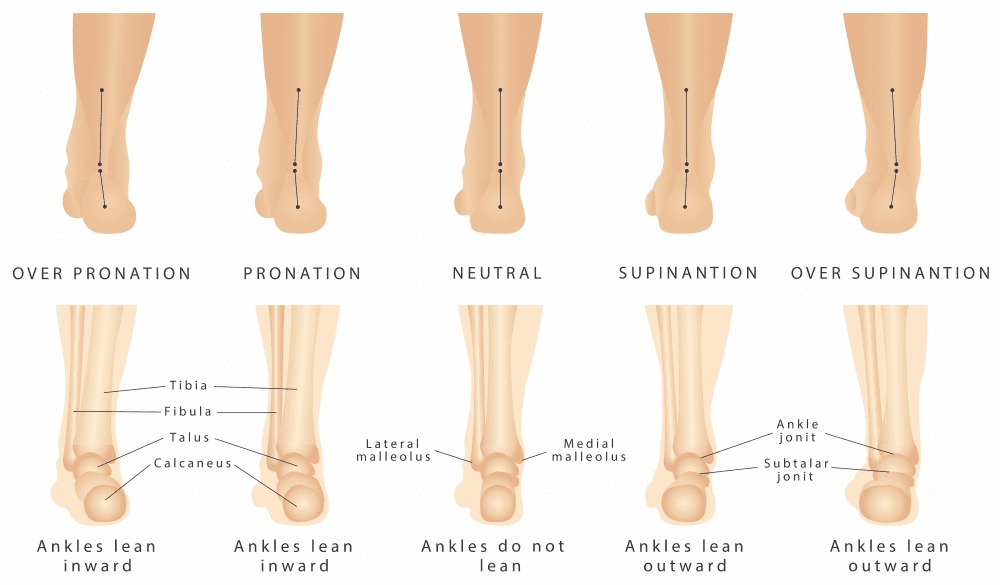 Foot and Ankle Surgical Associates - Did you know that as many as half ...