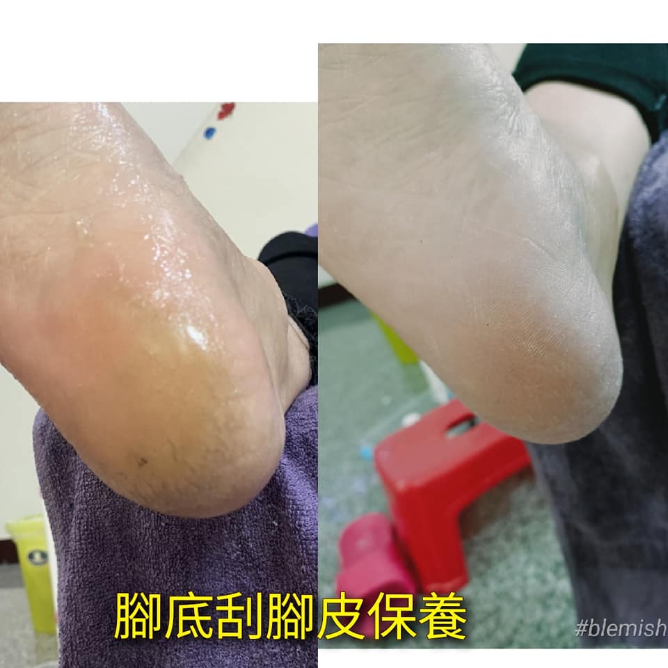 腳底刮腳皮保養只要450元腳底厚厚 彩虹美甲美睫台南灣裡mong Xinh Mi Xinh đai Nam Facebook