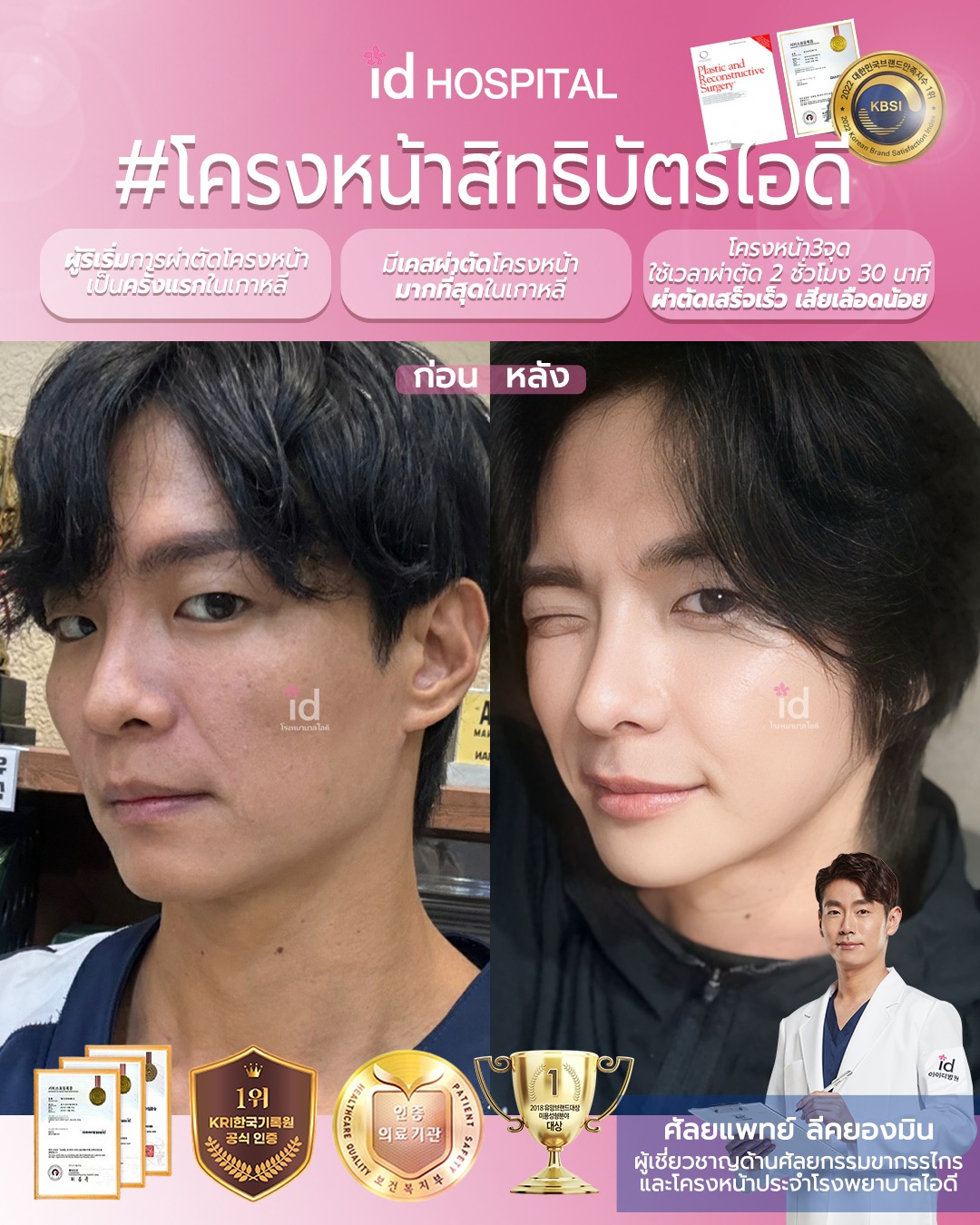 โรงพยาบาลศัลยกรรมไอดี - #รีวิว ความประทับใจหลังศัลยกรรมกับ id ค่ะ😊 บอก ...