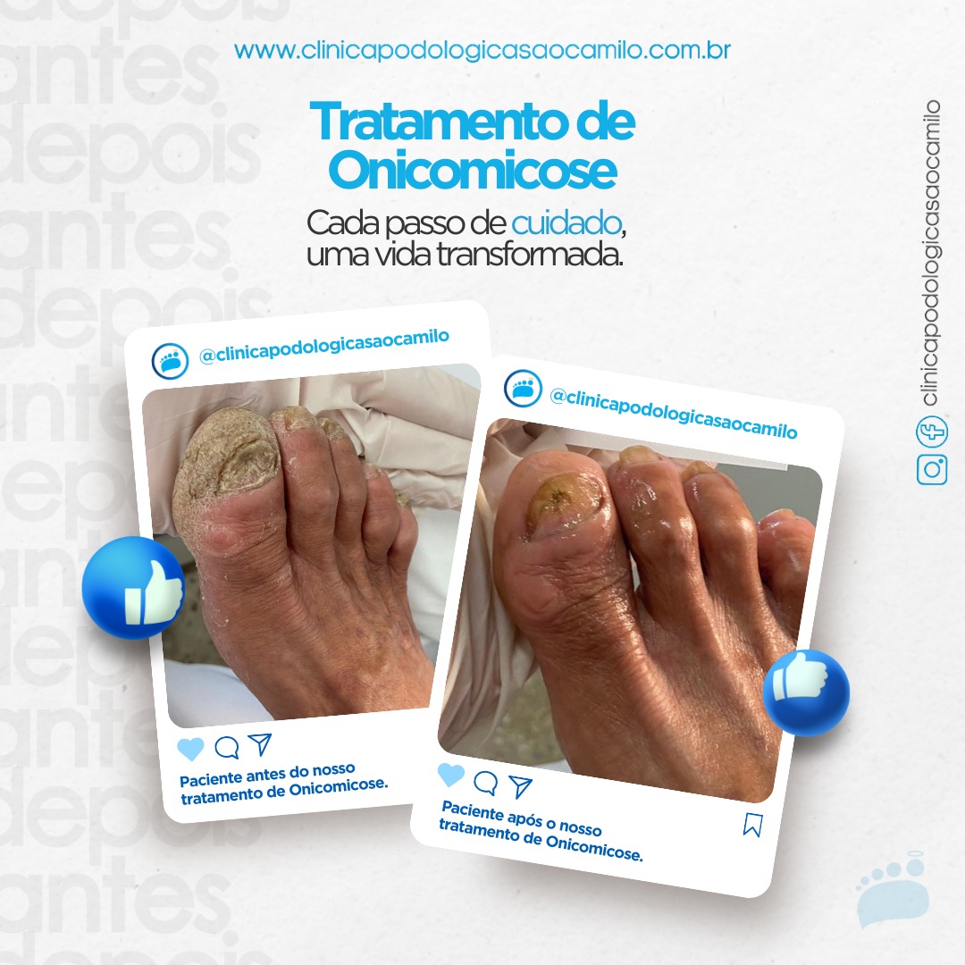 cl-nica-confira-neste-post-o-antes-e-o-depois-de-um-tratamento-de