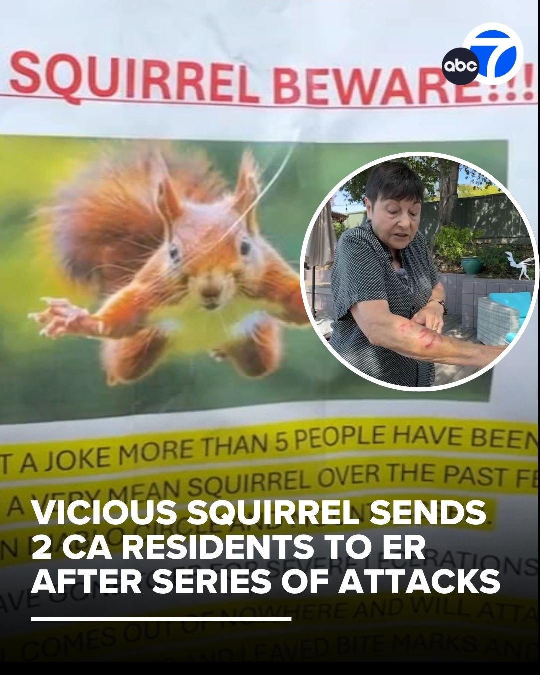 ABC7 - Some NorCal neighbors are on alert after a series of frightening ...