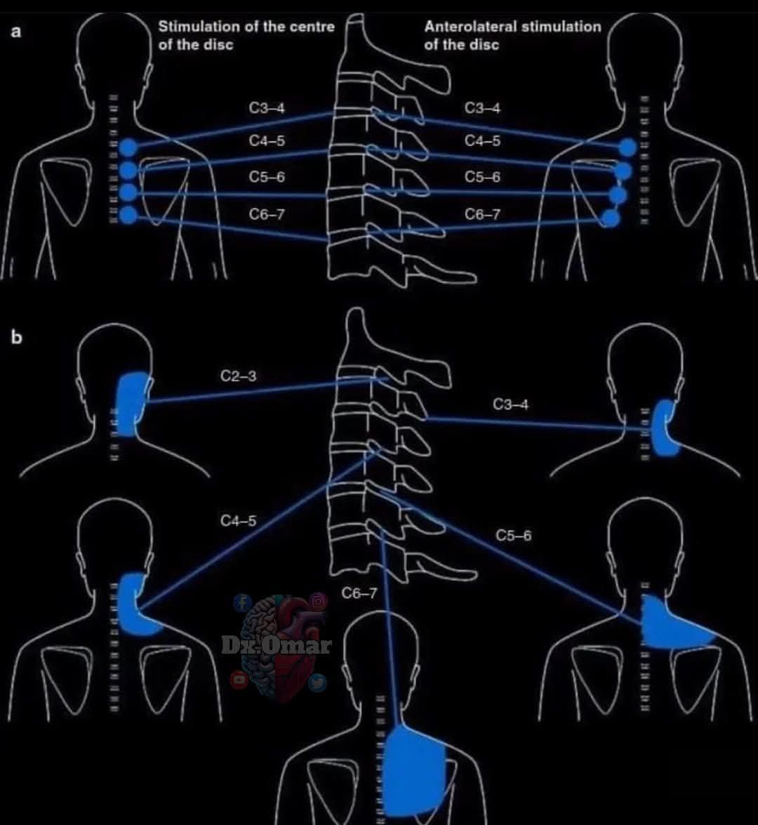 Quiroinka - 🚨🧠Áreas inervadas por los nervios C3, C4, C5, C6 y C7: C3 ...