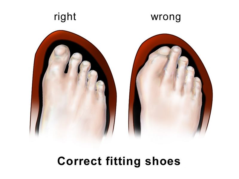 How Snug Should Shoes Fit: Ultimate Guide for Perfect Comfort