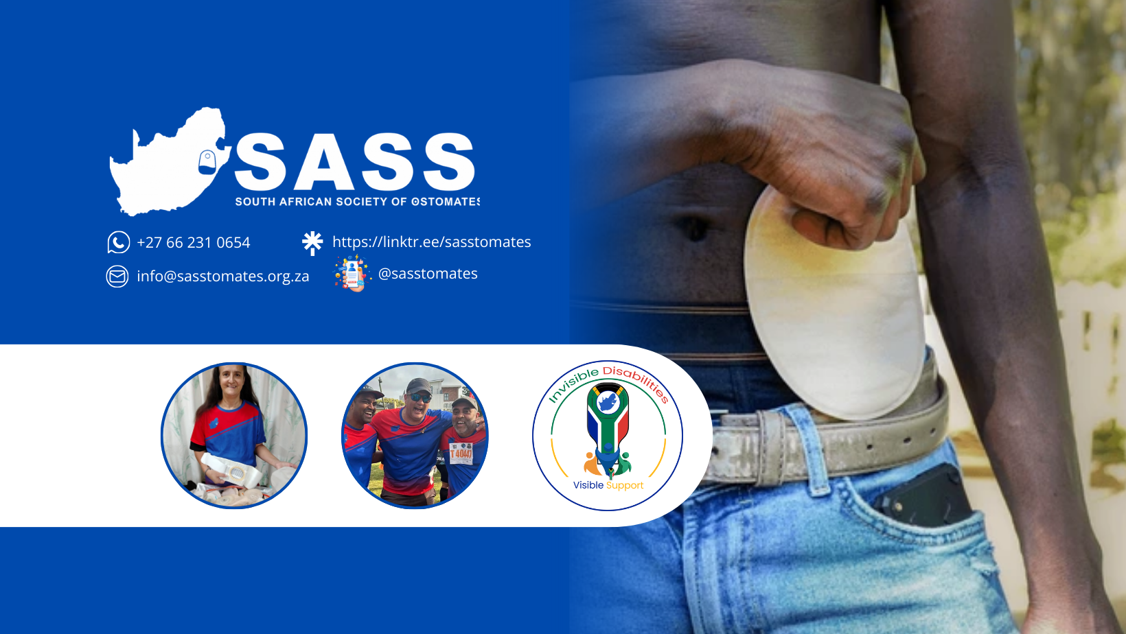 The South African Society of Ostomates - SASS
