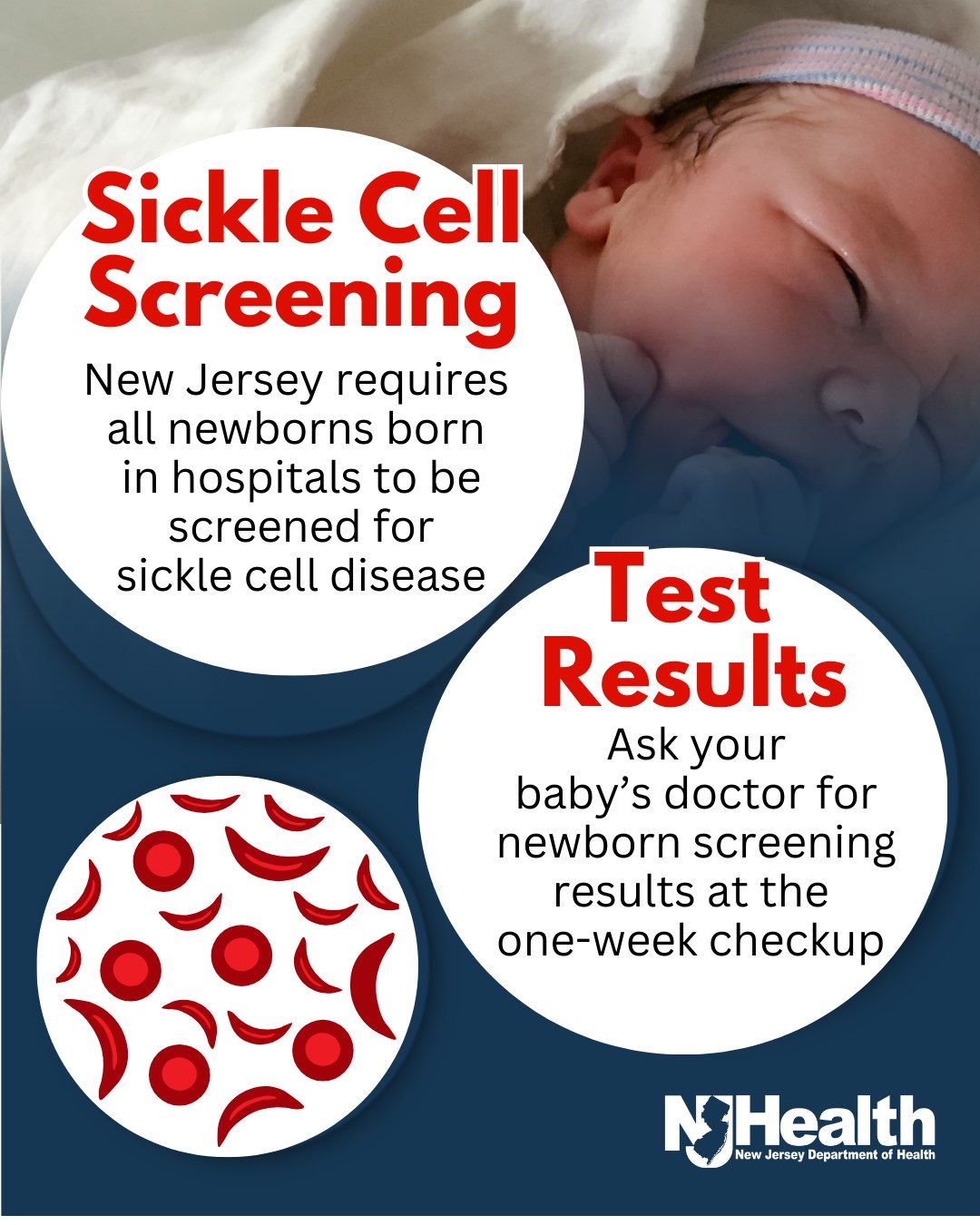 New - Newborn screening for sickle cell disease enables early diagnosis ...