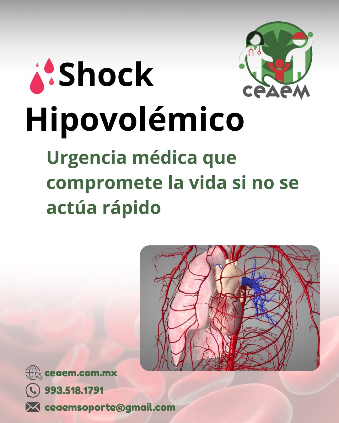 🚨 SHOCK HIPOVOLÉMICO: RECONOCER, PREVENIR Y ACTUAR El shock ...