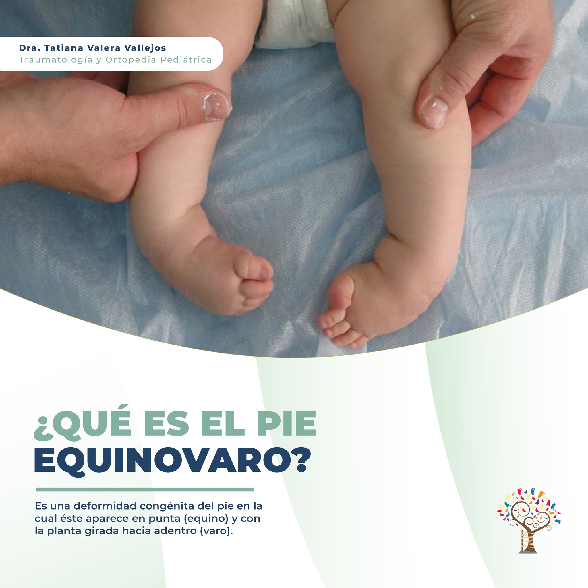 Dra. Tatiana Valera Vallejos - ¿Qué es el pie equinovaro?👩‍⚕️ Es una ...