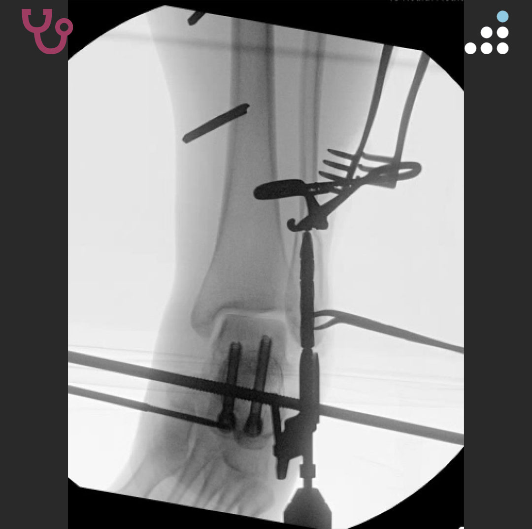 Orthobullets - Orthobullets added a new photo.
