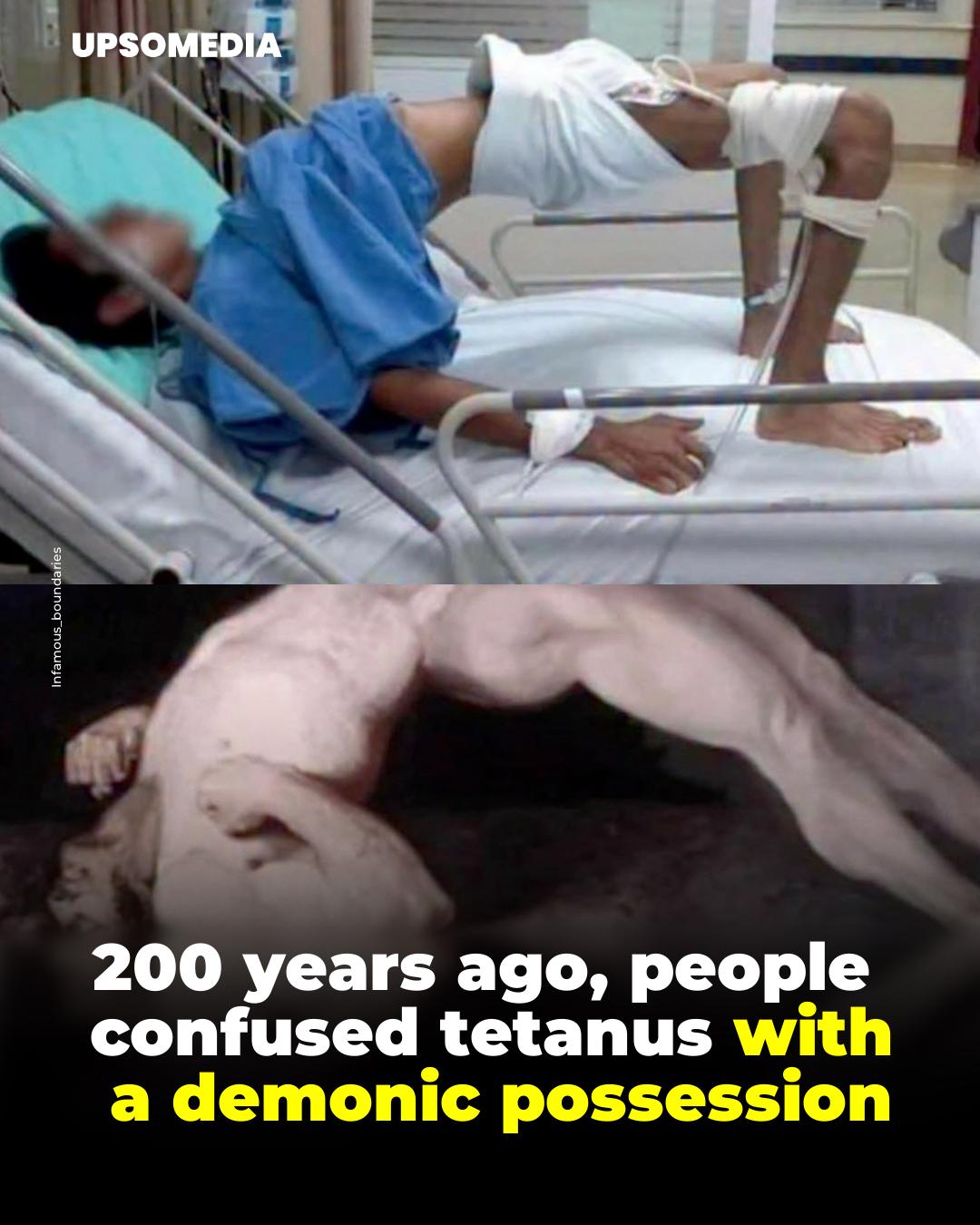 Vitamin - Two hundred years ago, tetanus was thought to be a demonic ...