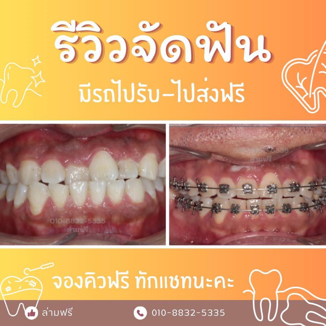 คลีนิกฟันในเกาหลีใต้ โซลคังนัม นัมหยางจู ซูวอน ชอน่าน อินชอน แทกู added ...