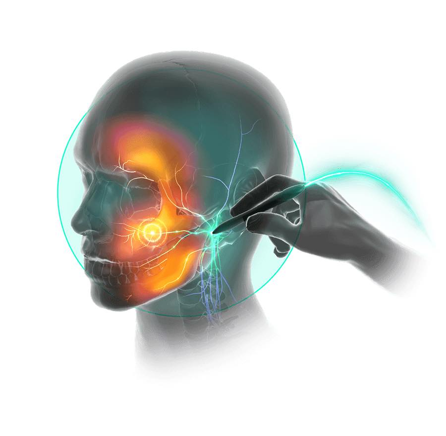 Rodney - The Stimpod NMS 460 is the World’s First Non-Invasive Pulsed ...