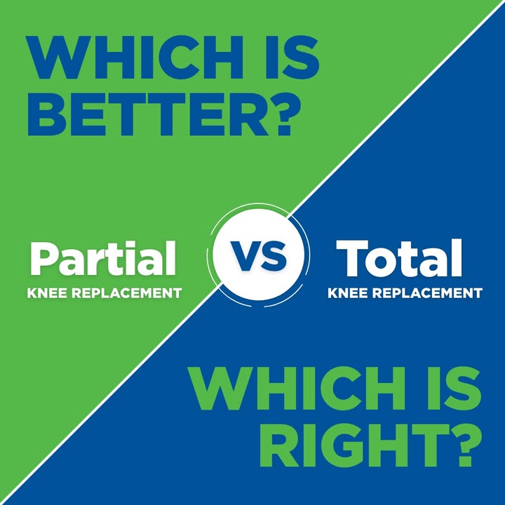Texas - Partial vs. Total Knee Replacement — which one is right for you ...