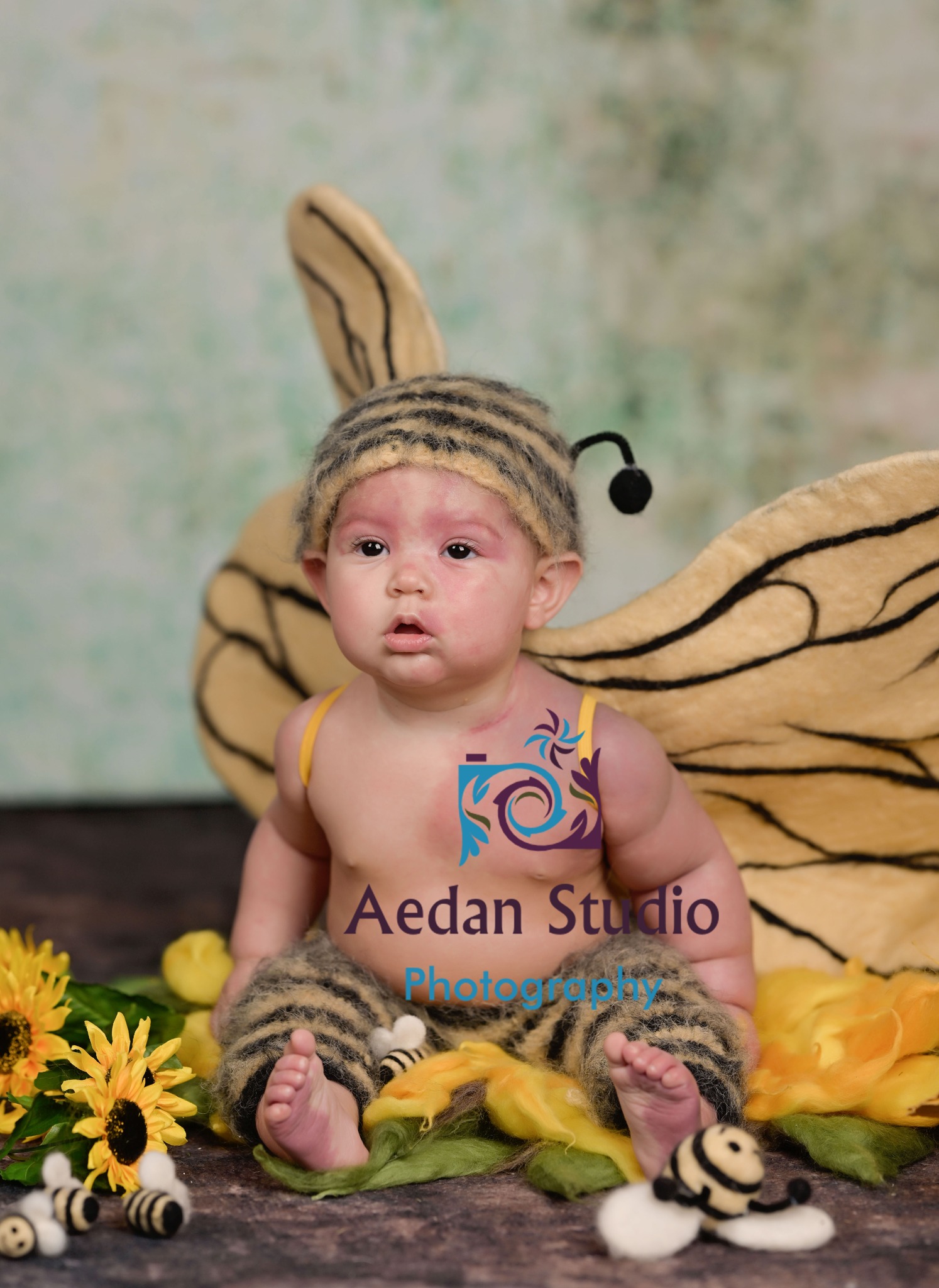 Aedan - This is Zaya, modeling our bee outfit She has capillary ...