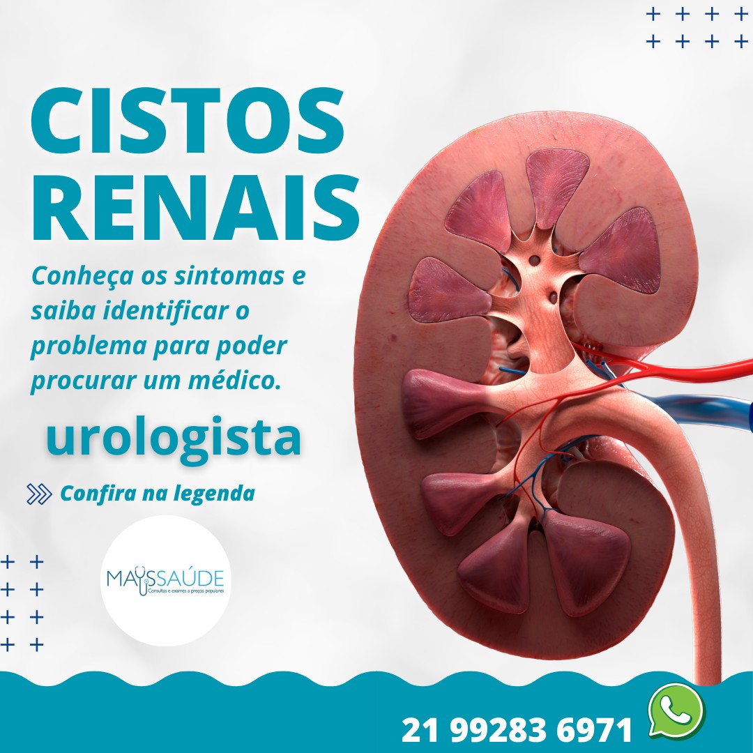Policlínica - 🩺 Cistos Renais: Quais os Sintomas? 🤔 Os cistos renais ...