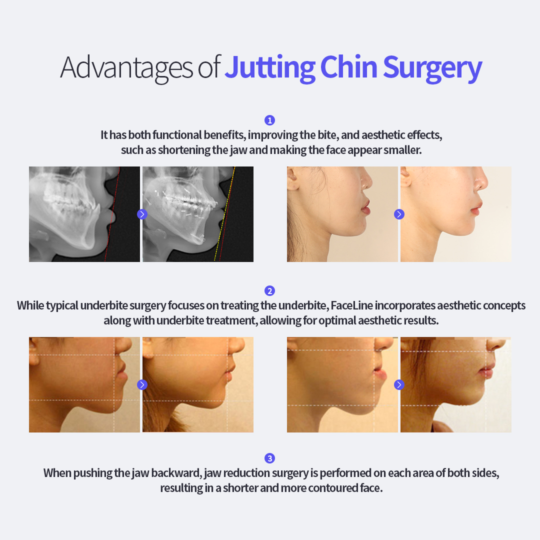 Korea Face-line... - Korea Face-line Surgery & Dental Clinic
