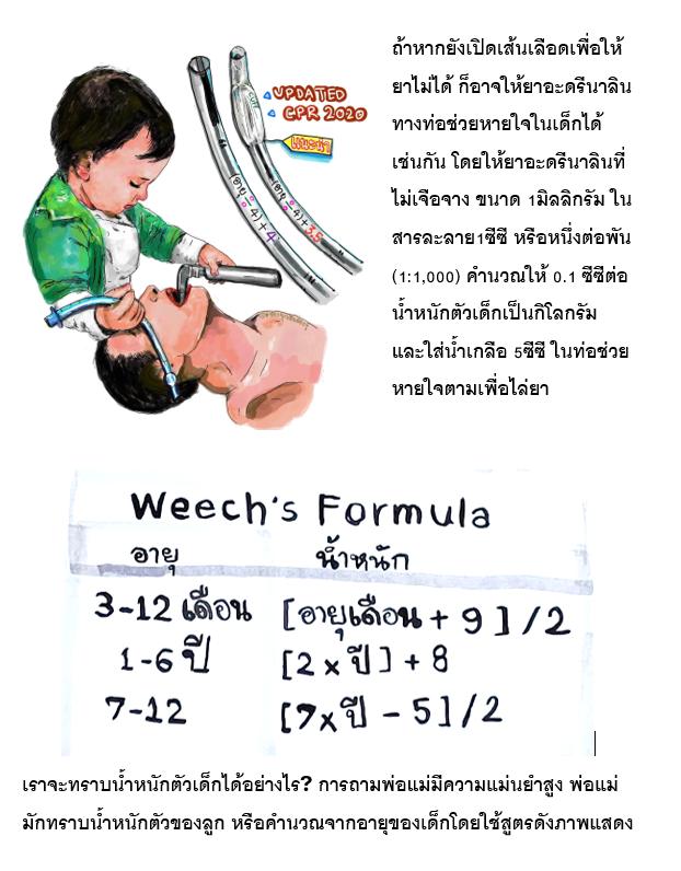 ปั๊มหัวใจเด็ก... - ห้องฉุกเฉินต้องรู้ | Facebook