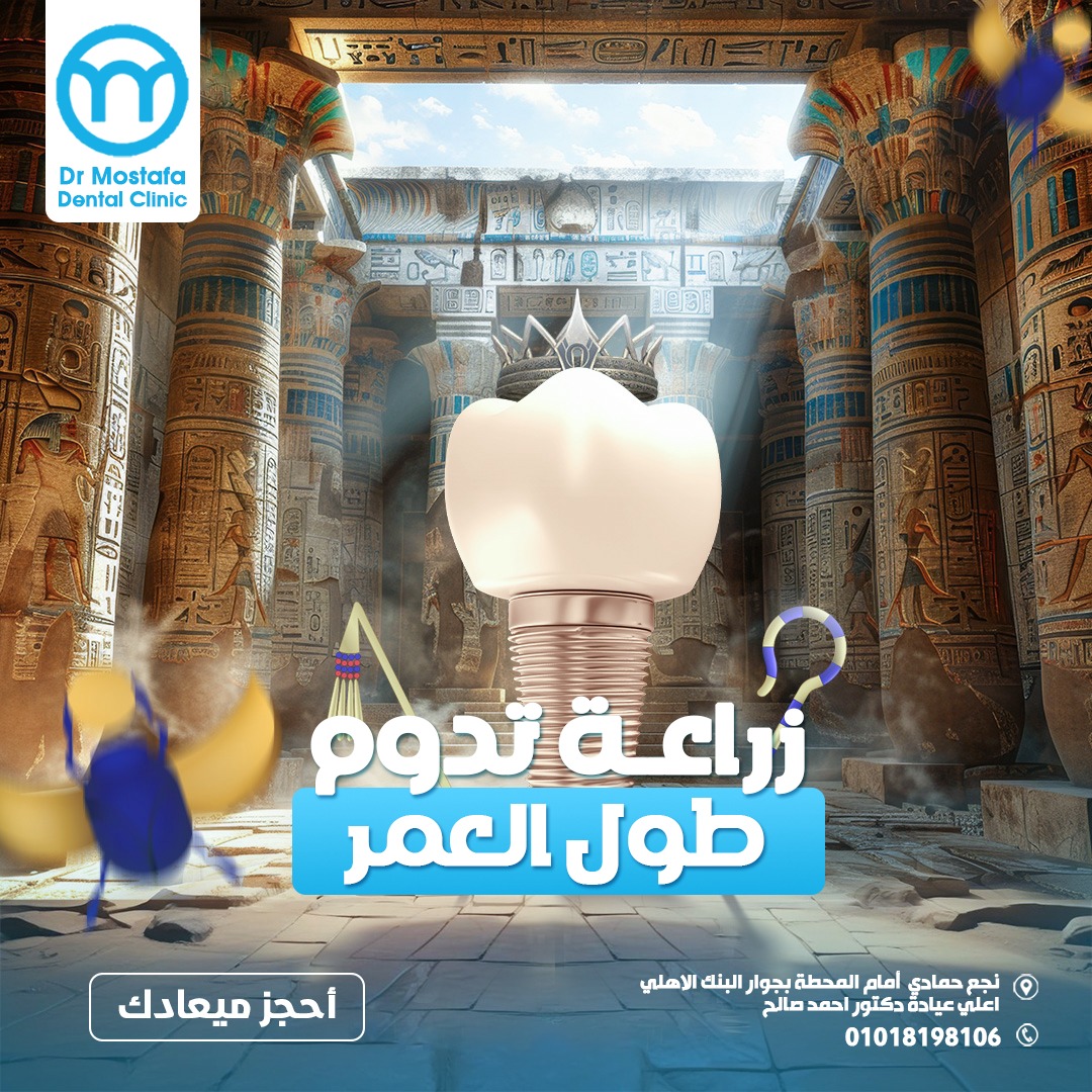 #زراعة_تدوم_طول_العمر... - Dr Mostafa Rady Dental Clinic | Facebook