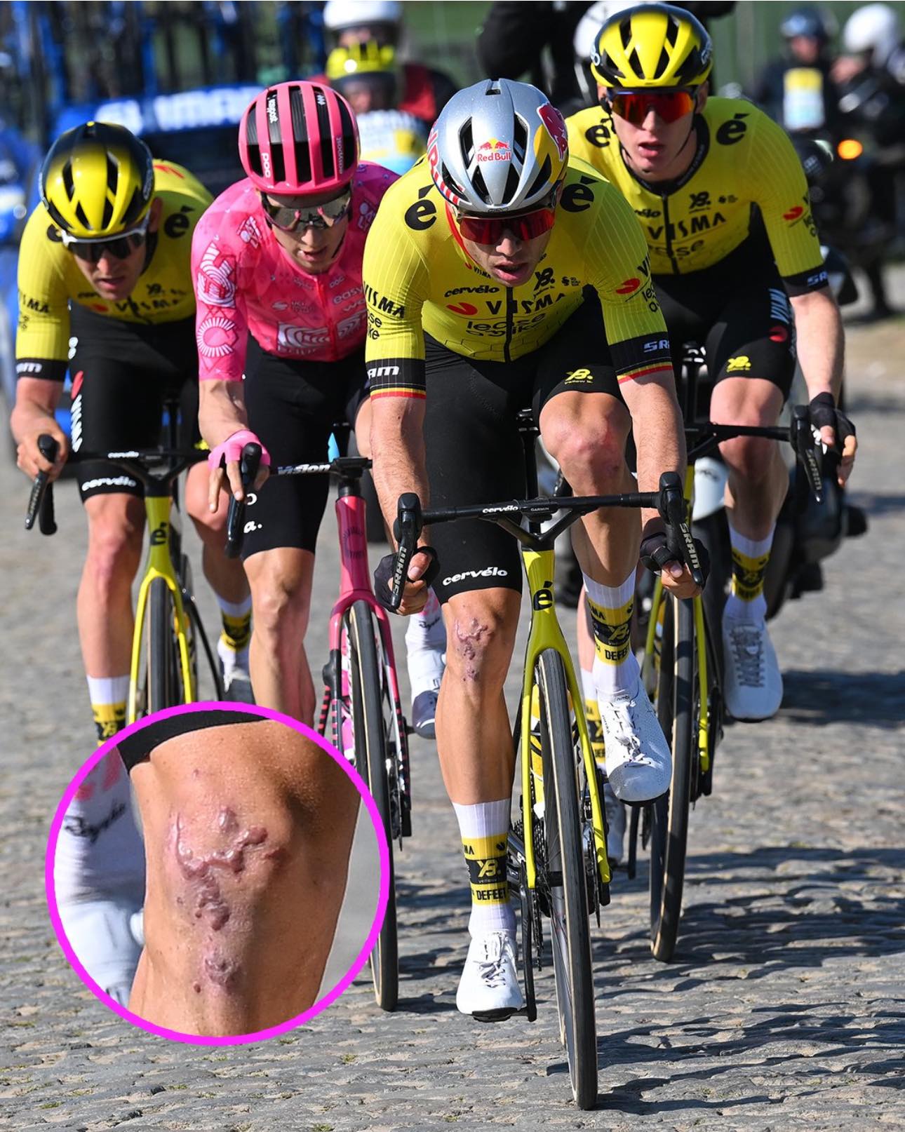 Cycling360 - Check out Wout van Aert's battle-scarred right knee 😳 ...