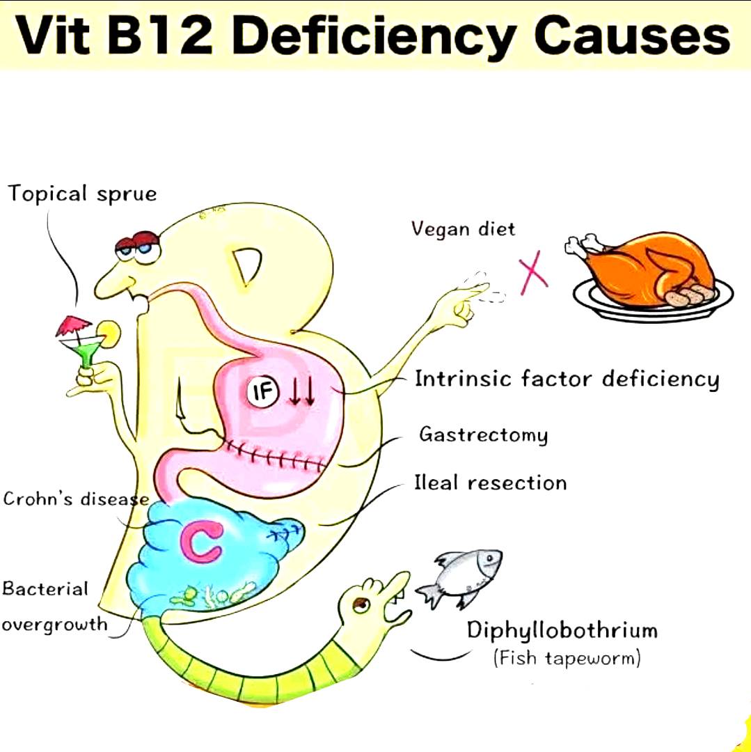 What can happen if you have a vitamin B12 deficiency?