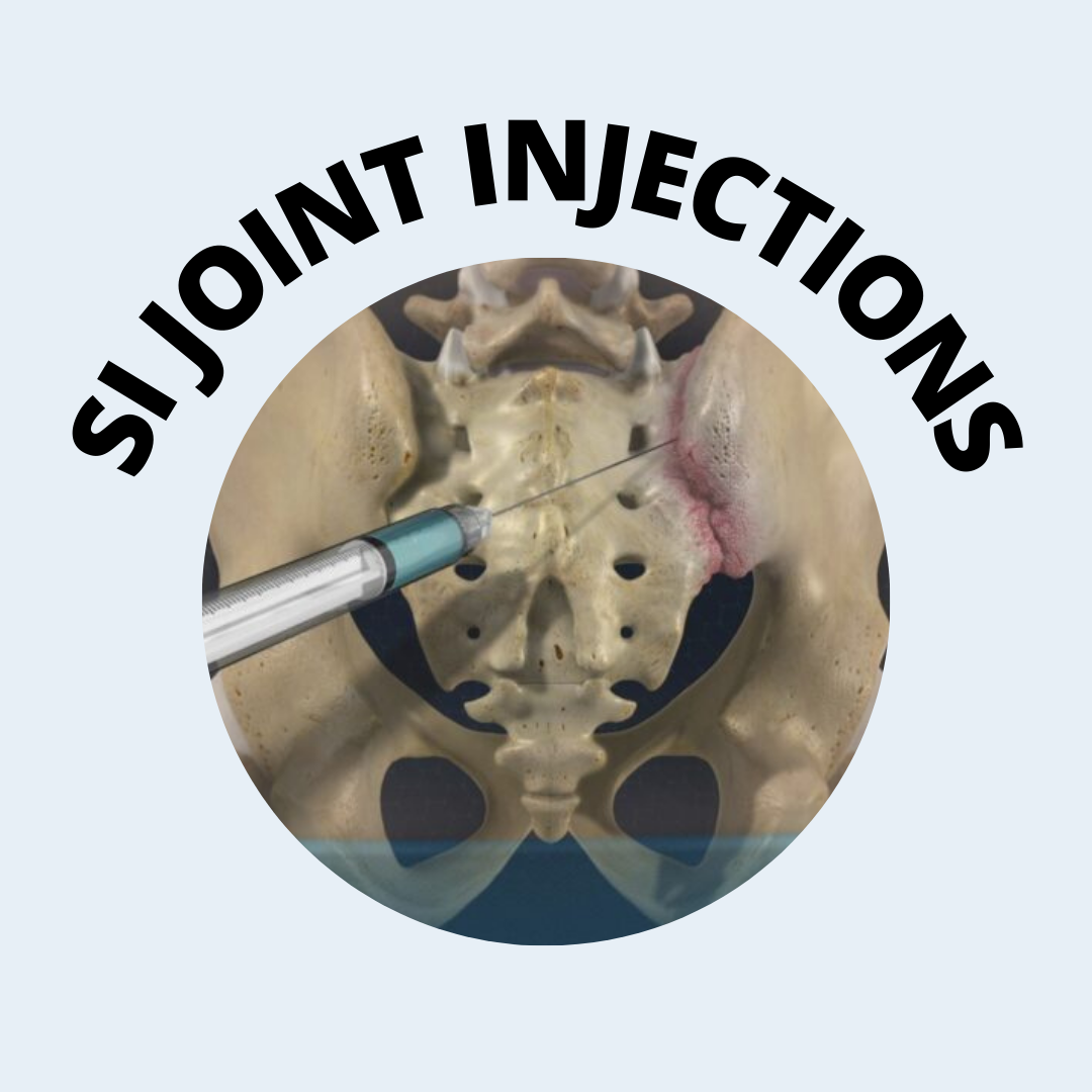 A sacroiliac (SI) join injection,... - Kansas Pain Management